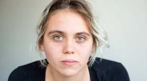 5 знака за недостиг на витамини, които буквално са изписани на лицето ви